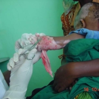 Impressionen Spital und Camp