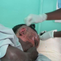 Impressionen Spital und Camp